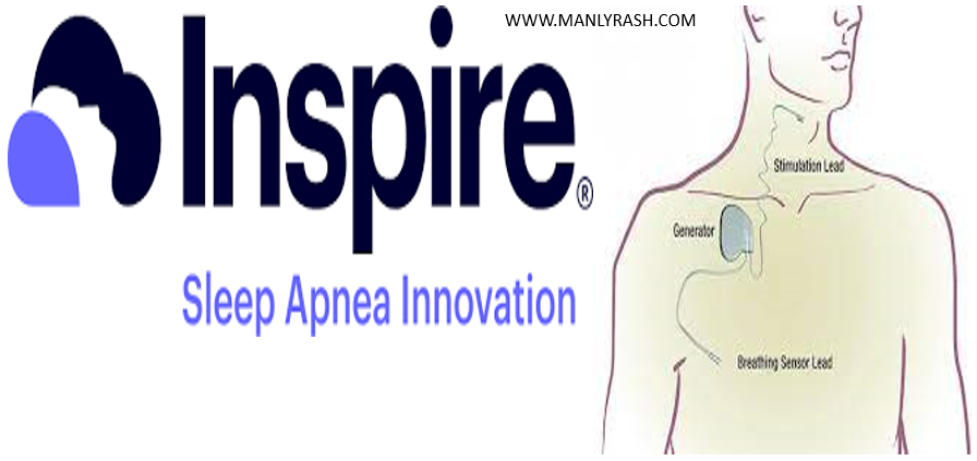 inspire sleep apnea