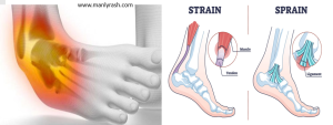 Sprains and Strains Prevention