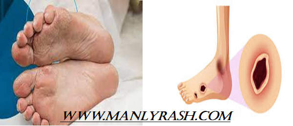 symptoms of diabetic foot infection
